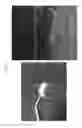 Fig. 02 - Artificial eardrum using silk protein and method of fabricating the same