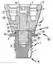 Fig. 01 - Percutaneous bone conduction implant