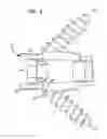 Fig. 07 - Stand alone anterior cage