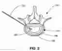 Fig. 04 - Bioadhesive hydrogels