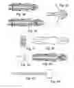 Fig. 07 - Integrated system for the ballistic and nonballistic infixion and retrieval of implants