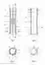 Fig. 02 - ENDOPROSTHESIS FOR ANATOMICAL DUCT