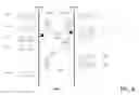 Fig. 09 - Crisscross cancellation protocol