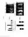 Fig. 08 - WNT PATHWAY MUTATIONS IN CANCER STEM CELLS