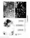 Fig. 07 - NEURAL TUMOR STEM CELLS AND METHODS OF USE THEREOF