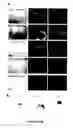 Fig. 09 - NEURAL TUMOR STEM CELLS AND METHODS OF USE THEREOF