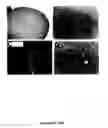 Fig. 22 - NEURAL TUMOR STEM CELLS AND METHODS OF USE THEREOF