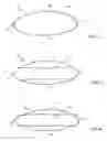 Fig. 03 - METHOD FOR SURFACE STRENGTHENING AND SMOOTHENING OF METALLIC COMPONENTS