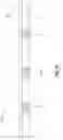 Fig. 07 - CONCRETE BEAM ASSEMBLY