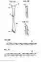 Fig. 06 - METHOD AND DEVICE FOR IMPLEMENTING SIMULATED TEST OF CENTRIFUGAL STRESS IN TURBINE BLADE