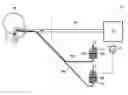 Fig. 01 - System for Artificial Respiration of Persons