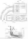 Fig. 01 - DYNAMIC ADJUSTMENT OF TUBE COMPENSATION FACTOR BASED ON INTERNAL CHANGES IN BREATHING TUBE