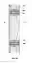 Fig. 09 - Expandable reamer for subterranean boreholes and methods of use