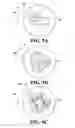 Fig. 09 -  NOZZLE WITH CHANNELS THAT IMPART AN ANGULAR MOMENTUM TO THE EXITING FLUID AND METHODS FOR MAKING AND USING SAME