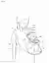 Fig. 17 - BABY CARRIER