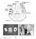 Fig. 01 - Phantoms and methods for verification in radiotherapy systems