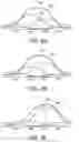 Fig. 06 - Method and system for driving a backlight in a display