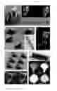Fig. 09 - MICRODEVICE FABRICATION