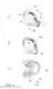 Fig. 02 - Hearing aid