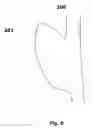 Fig. 02 - AUTOMATIC GEOMETRICAL AND MECHANICAL ANALYZING METHOD AND SYSTEM FOR TUBULAR STRUCTURES