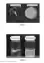 Fig. 03 - SOLID IN OIL/WATER EMULSION-DIFFUSION-EVAPORATION FORMULATION FOR PREPARING CURCUMIN-LOADED PLGA NANOPARTICLES