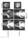 Fig. 14 - Imaging Agents and Methods