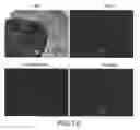 Fig. 17 - Imaging Agents and Methods