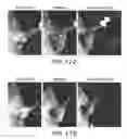 Fig. 18 - Imaging Agents and Methods