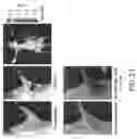 Fig. 22 - Imaging Agents and Methods