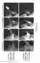 Fig. 24 - Imaging Agents and Methods