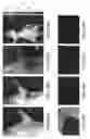 Fig. 29 - Imaging Agents and Methods