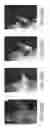 Fig. 30 - Imaging Agents and Methods