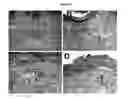 Fig. 09 - Sealants for Skin and Other Tissues