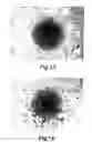 Fig. 08 - Therapeutic Agent