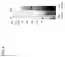 Fig. 10 - Method of using cell-free protein synthesis to produce a membrane protein