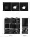 Fig. 09 - Immunogenic compositions comprising progastrin and uses thereof