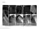 Fig. 02 - Compositions as Wound Sealant