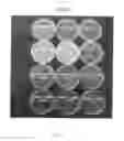 Fig. 02 - Anti-infection P-compound™