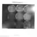 Fig. 04 - Anti-infection P-compound™