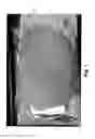 Fig. 02 - JOINTING COMPOSITION AND METHOD