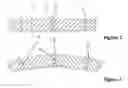 Fig. 03 - Method for manufacturing a three-dimensionally deformable, sheet-like reinforcing structure