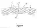 Fig. 05 - Method for manufacturing a three-dimensionally deformable, sheet-like reinforcing structure