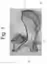 Fig. 02 - Tongue block