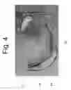 Fig. 05 - Tongue block