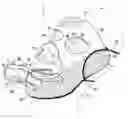 Fig. 01 - Device for positioning and immobilizing a surgical guide in a patient's mouth