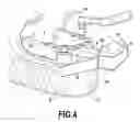 Fig. 04 - Device for positioning and immobilizing a surgical guide in a patient's mouth