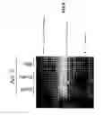 Fig. 07 - Methods for detecting a target nucleotide sequence in a sample utilising a nuclease-aptamer complex