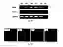 Fig. 06 - REDUCER OF IMMUNOSUPPRESSION BY TUMOR CELL AND ANTITUMOR AGENT USING THE SAME