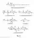 Fig. 16 - Lanthanide Complexes as Fluorescent Indicators for Neutral Sugars and Cancer Diagnosis