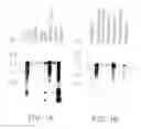 Fig. 02 - Neurotrophic factors and methods of use thereof